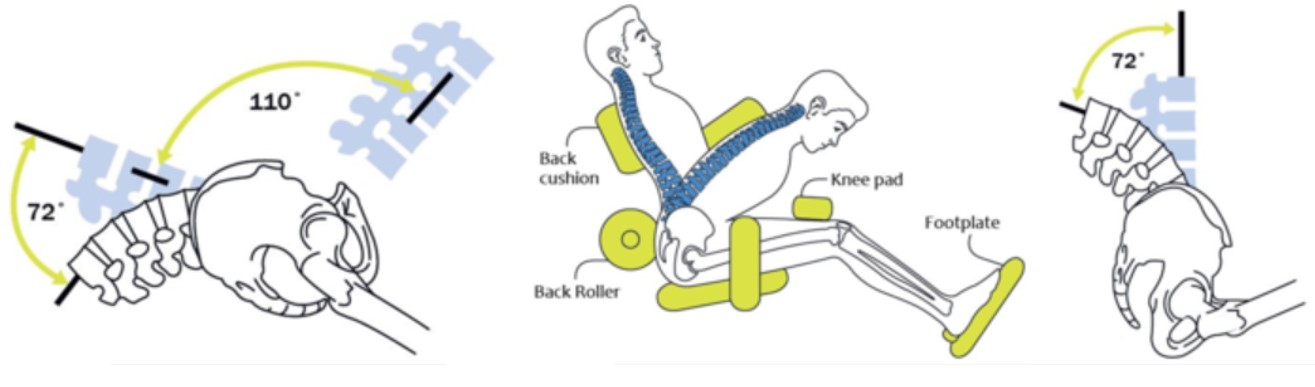 Spinal Anatomy Diagram